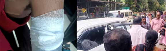 മൂന്നാം ക്ലാസുകാരനെ ഇസ്തിരിപ്പെട്ടി കൊണ്ട് പൊള്ളലേ‍ൽപ്പിച്ച രണ്ടാനച്ഛൻ അറസ്റ്റിൽ