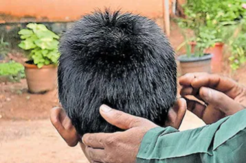 വിദ്യാർഥികളുടെ കണ്ണിൽ പശ തേച്ച് സഹപാഠികളുടെ തമാശ; കൺപോള തുറക്കാനാകാതെ കുട്ടികൾ ആശുപത്രിയിൽ