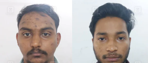 ആദിലിന്റെ പേരിലുള്ളത് ‘മ്യൂൾ അക്കൗണ്ട്’, മറിഞ്ഞത് കോടികൾ; ക്രൈം പോർട്ടലിലുള്ളത് 31 പരാതികൾ