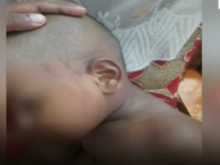 പിഞ്ചുകുഞ്ഞിനോട് അങ്കണവാടി ടീച്ചറുടെ ക്രൂരത; മുഖത്ത് കൈവീശി അടിച്ചു