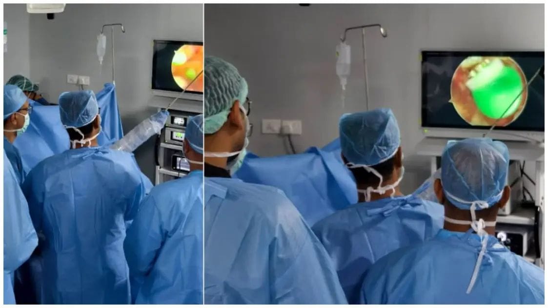 വയനാട് മെഡിക്കൽ കോളേജിൽ ചരിത്രനേട്ടം; അതിസങ്കീർണമായ തോൾ ശസ്ത്രക്രിയ വിജയകരം