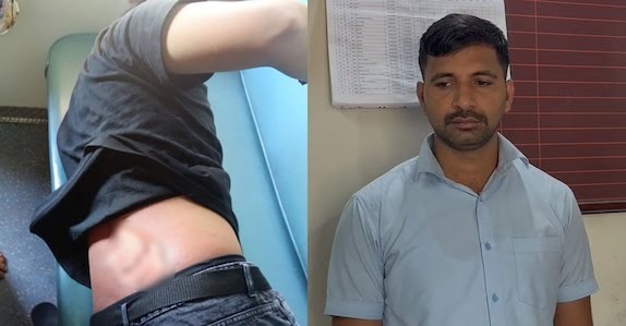 ചില്ലറ ചോദിച്ചതോടെ തർക്കം, യാത്രക്കാരന്റെ ദേഹത്ത് തിളച്ച വെള്ളം ഒഴിച്ചു;  ജീവനക്കാരൻ അറസ്റ്റിൽ