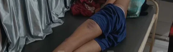 വിനോദയാത്രയിലെ തർക്കം തീർക്കാൻ വിളിച്ചുവരുത്തി; പ്ലസ് ടു വിദ്യാർഥികളെ അധ്യാപകനും സുഹൃത്തുക്കളും ക്രൂരമായി മർദിച്ചു