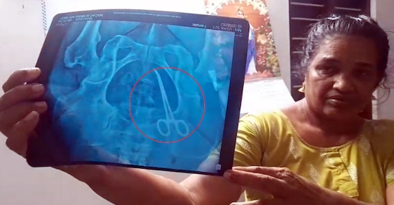 വയറിൽ കത്രികയുമായി 5 കൊല്ലം, വീട്ടമ്മയെ ഗുളിക കൊടുത്തു മടക്കി