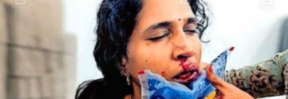 ക്ലാസിൽ ഗെയിം കളിക്കരുതെന്ന് താക്കീത്; അധ്യാപികയുടെ മൂക്കിടിച്ചു പരത്തി വിദ്യാർഥി