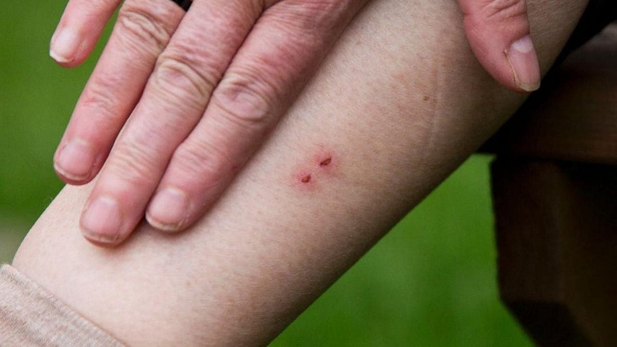 ‘ആന്റിവെനത്തില്‍ വീഴ്ച പാടില്ല, കൃത്യമായ ചികിത്സ നല്‍കണം’; ഡിഎംഒമാര്‍ക്ക് നിര്‍ദേശം